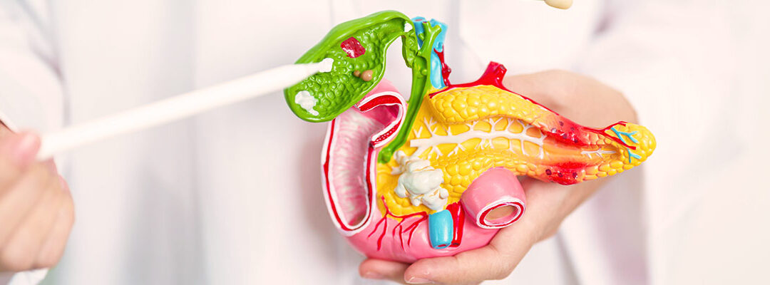 Cálculos biliares: síntomas, riesgos y cómo tratarlos sin cirugía tradicional