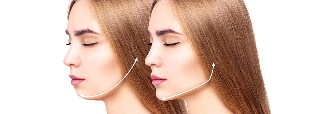 Mentoplastia: cirugía del mentón para lograr un rostro más equilibrado y armónico